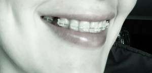 Day Ten : and we're smiling